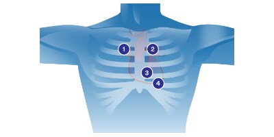 cardiac ascultation diagram
