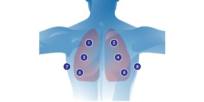 Pulmonary auscultation diagram
